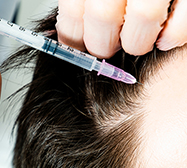 FuegoBod Hair Restoration